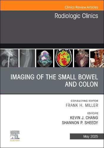 Cover image for Imaging of the Small Bowel and Colon, An Issue of Radiologic Clinics of North America: Volume 63-3