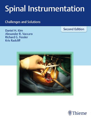 Cover image for Spinal Instrumentation: Challenges and Solutions