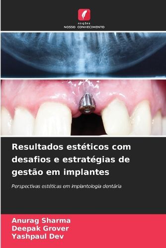 Cover image for Resultados esteticos com desafios e estrategias de gestao em implantes