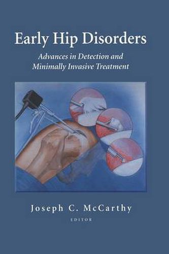 Early Hip Disorders: Advances in Detection and Minimally Invasive Treatment