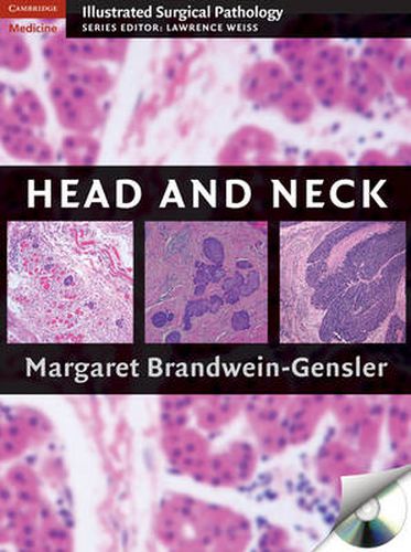 Cover image for Head and Neck