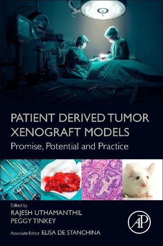 Cover image for Patient Derived Tumor Xenograft Models: Promise, Potential and Practice