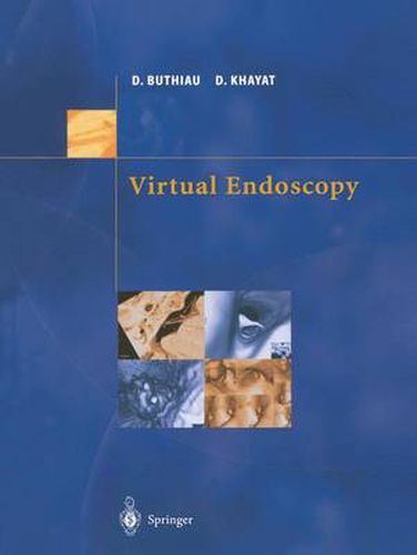 Cover image for Virtual Endoscopy