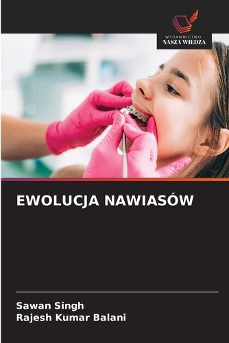 Cover image for Ewolucja Nawiasow