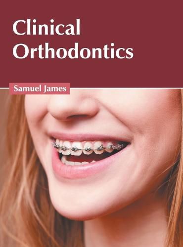 Cover image for Clinical Orthodontics