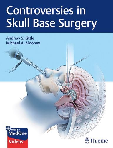 Cover image for Controversies in Skull Base Surgery