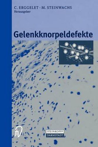 Cover image for Gelenkknorpeldefekte