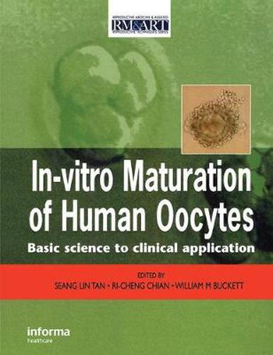 Cover image for In Vitro Maturation of Human Oocytes