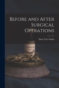 Cover image for Before and After Surgical Operations