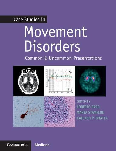 Cover image for Case Studies in Movement Disorders: Common and Uncommon Presentations