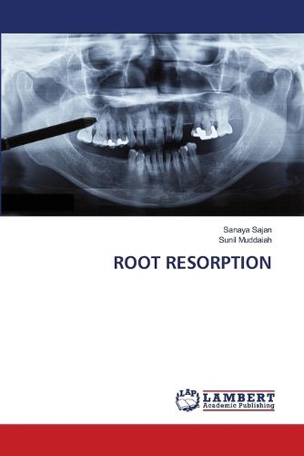 Cover image for Root Resorption