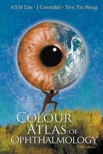 Cover image for Colour Atlas Of Ophthalmology (Fifth Edition)