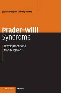 Cover image for Prader-Willi Syndrome: Development and Manifestations