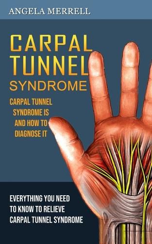 Cover image for Carpal Tunnel Syndrome: Carpal Tunnel Syndrome is and How to Diagnose It (Everything You Need to Know to Relieve Carpal Tunnel Syndrome)