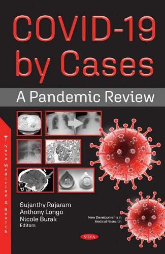 Cover image for COVID-19 by Cases: A Pandemic Review