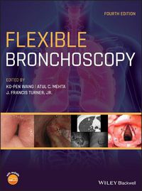 Cover image for Flexible Bronchoscopy 4e