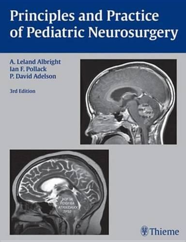 Cover image for Principles and Practice of Pediatric Neurosurgery