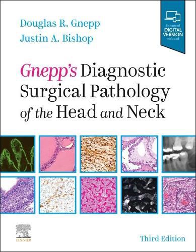 Cover image for Gnepp's Diagnostic Surgical Pathology of the Head and Neck