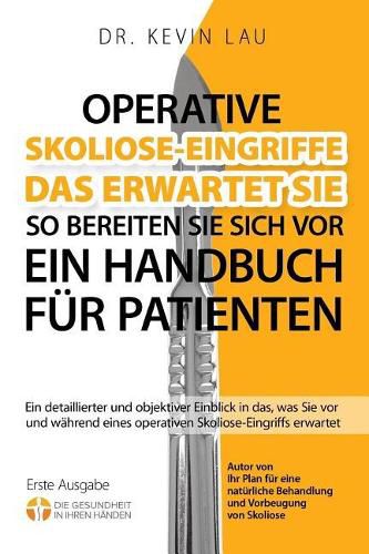 Cover image for Operative Skoliose-Eingriffe - das erwartet Sie - so bereiten Sie sich vor (2.): Ein detaillierter und objektiver Einblick in das, was Sie vor und wahrend eines operativen Skoliose-Eingriffs erwartet