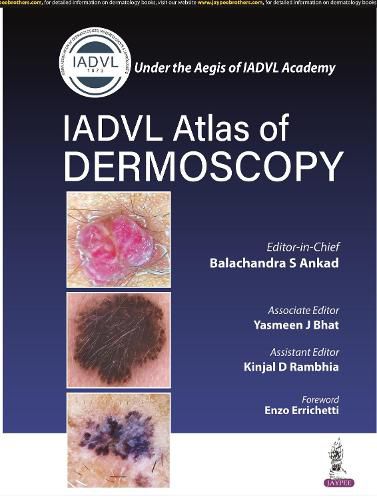 Cover image for Atlas of Dermoscopy