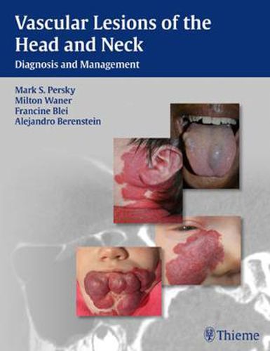 Cover image for Vascular Lesions of the Head and Neck: Diagnosis and Management