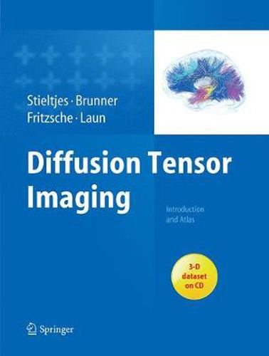 Cover image for Diffusion Tensor Imaging: Introduction and Atlas