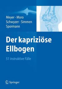 Cover image for Der kaprizioese Ellbogen: 51 instruktive Falle