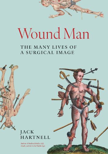 Cover image for Wound Man
