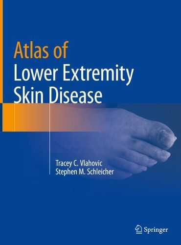 Cover image for Atlas of Lower Extremity Skin Disease