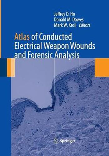 Cover image for Atlas of Conducted Electrical Weapon Wounds and Forensic Analysis