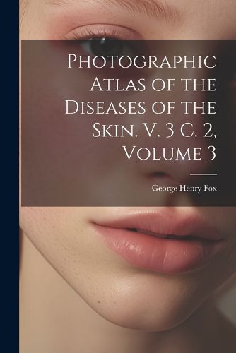 Photographic Atlas of the Diseases of the Skin. V. 3 C. 2, Volume 3