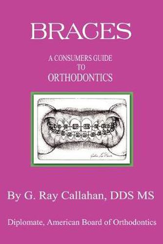 Cover image for Braces: A Consumers Guide to Orthodontics