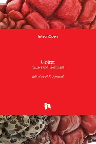 Cover image for Goiter: Causes and Treatment