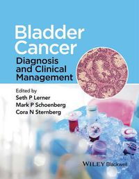 Cover image for Bladder Cancer: Diagnosis and Clinical Management