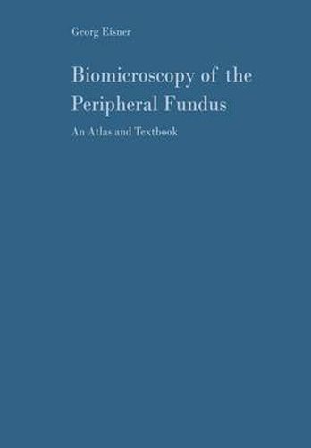 Cover image for Biomicroscopy of the Peripheral Fundus: An Atlas and Textbook