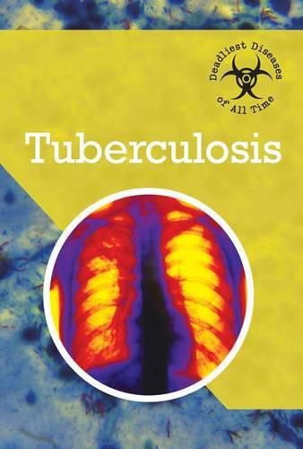 Cover image for Tuberculosis