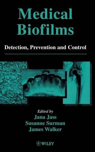 Cover image for Medical Biofilms: Detection, Prevention and Control