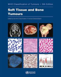 Cover image for WHO classification of tumours of soft tissue and bone tumours