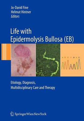 Life with Epidermolysis Bullosa (EB): Etiology, Diagnosis, Multidisciplinary Care and Therapy