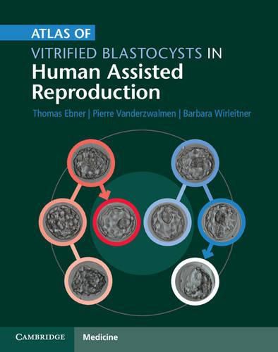 Cover image for Atlas of Vitrified Blastocysts in Human Assisted Reproduction