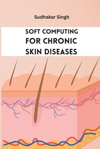 Cover image for Soft Computing for Chronic Skin Diseases