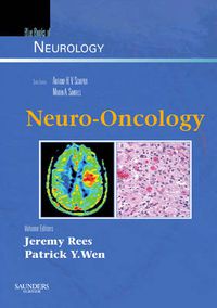 Cover image for Neuro-Oncology: Blue Books of Neurology Series