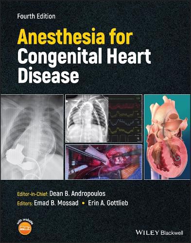 Cover image for Anesthesia for Congenital Heart Disease