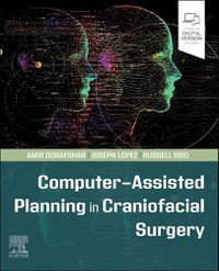 Cover image for Computer-Assisted Planning in Craniofacial Surgery