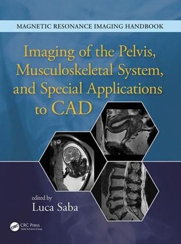 Cover image for Imaging of the Pelvis, Musculoskeletal System, and Special Applications to CAD