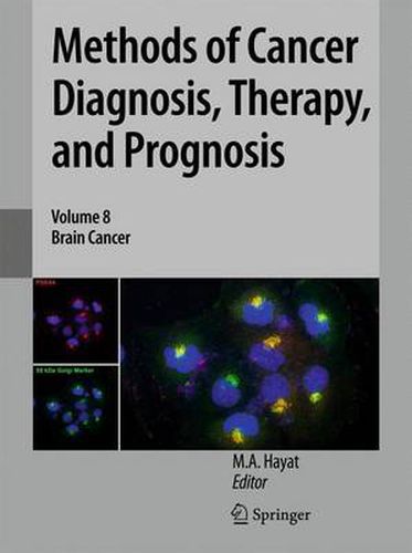 Cover image for Methods of Cancer Diagnosis, Therapy, and Prognosis: Brain Cancer