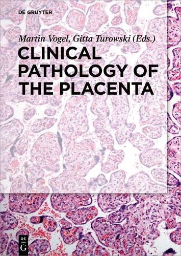 Cover image for Clinical Pathology of the Placenta