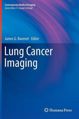 Cover image for Lung Cancer Imaging