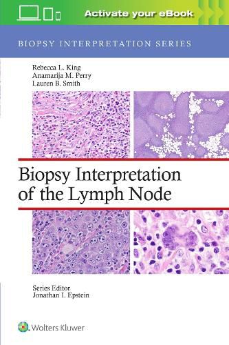 Biopsy Interpretation of the Lymph Nodes