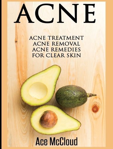 Cover image for Acne: Acne Treatment: Acne Removal: Acne Remedies For Clear Skin